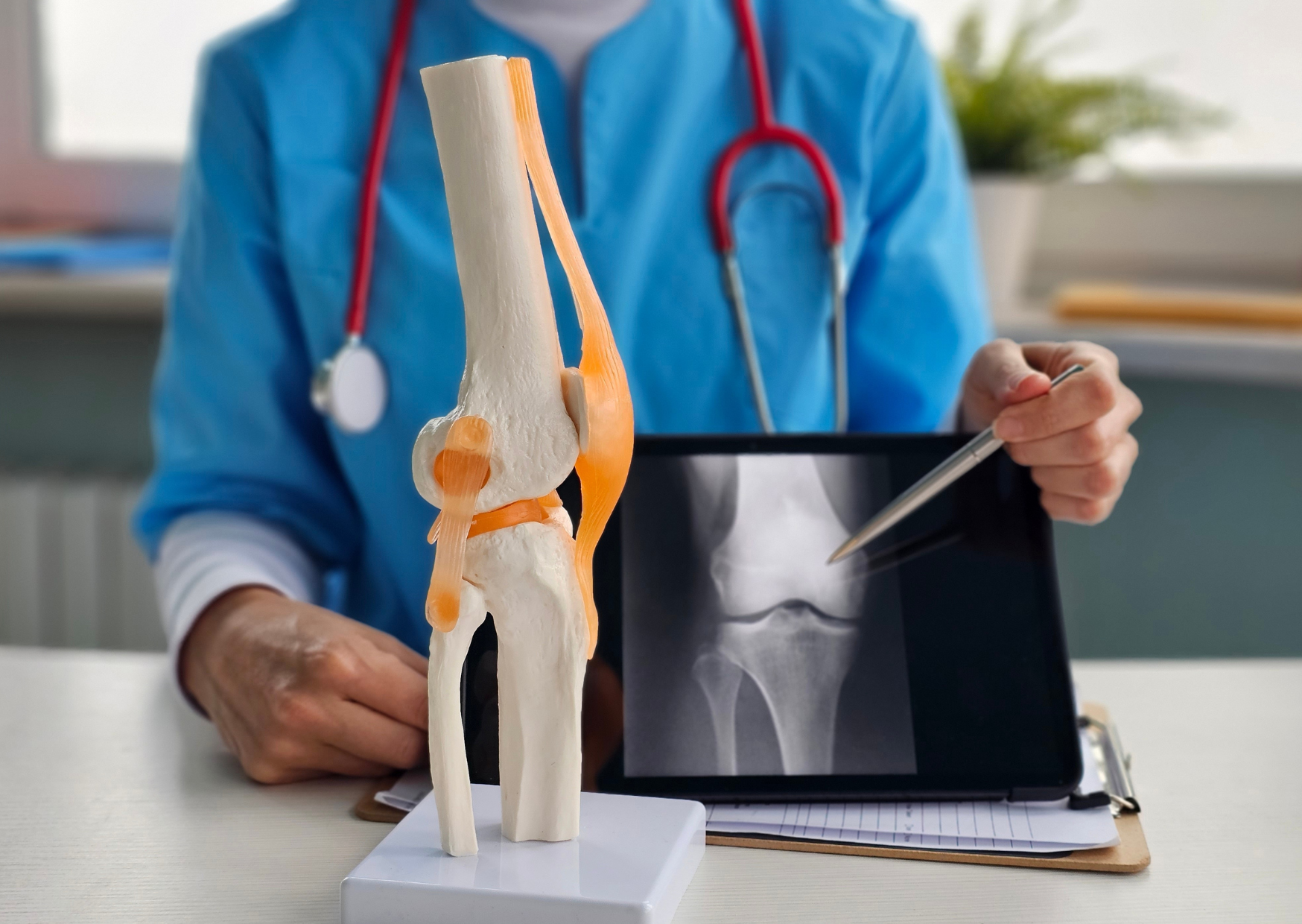 Knee Replacement